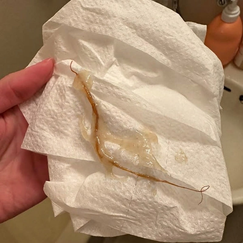 4. Dark Mucus Means the Hard Stuff Is Finally Moving